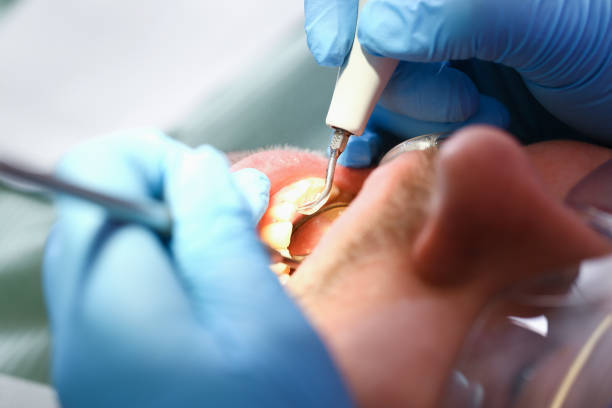Best Emergency Wisdom Teeth Removal in Paw Paw Lake, MI