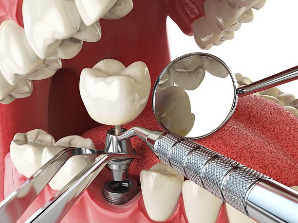 Best Emergency Treatment for Toothache in Paw Paw Lake, MI